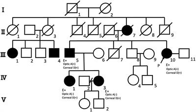 Case report: Corneal endothelial degeneration and optic atrophy in dentatorubral-pallidoluysian atrophy quantified by specular micrography and optical coherence tomography